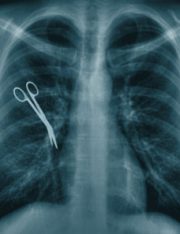 Top Injuries Claimed in Medical Malpractice Lawsuits