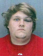 Vomiting On A Person Is Assault And You Don’t Have To Take It