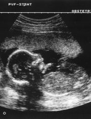 Can You Sue For A Wrongful Death That Occurred Before You Were Born?