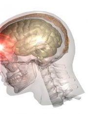 Should People With a Traumatic Brain Injury Be Criminally Culpable?